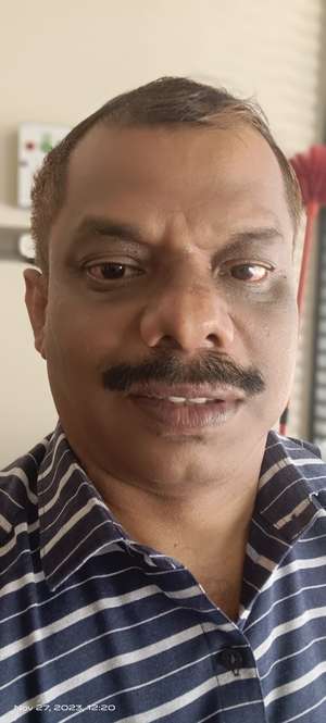 RINOSH