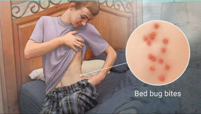#bedbugs treatment 🐞